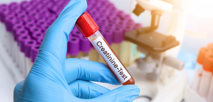 Creatinina marita (crescuta) - ce inseamna, cauze posibile si interpretarea analizelor