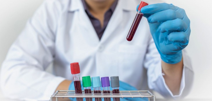 Deficit de vitamina B12 si anemie: simptome, cauze, diagnostic si rolul hematologului