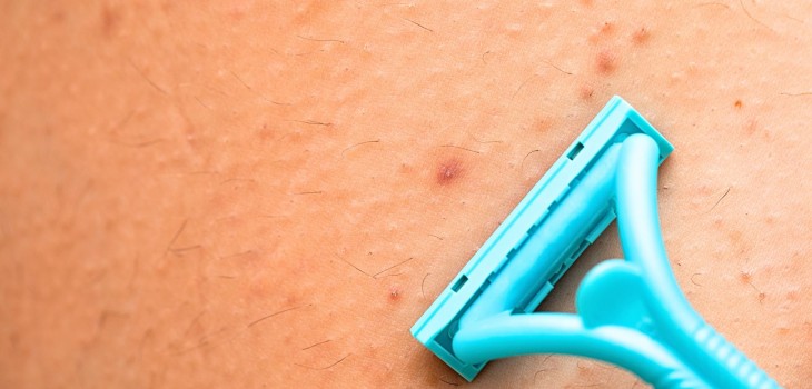 Foliculita: Cauze, simptome și tratament pentru inflamația foliculilor piloși