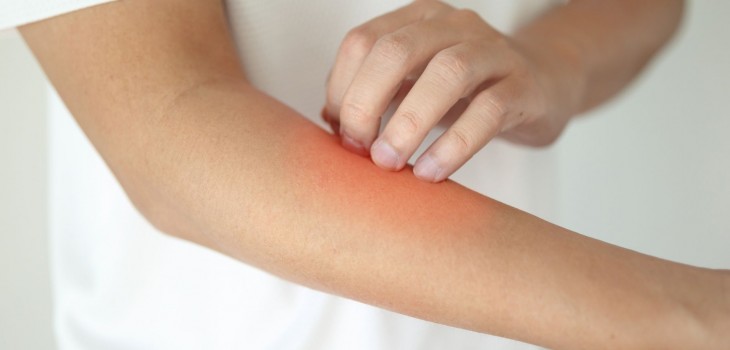 Infectiile fungice: cauze, simptome, tipuri si cand pot deveni periculoase