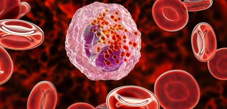 Neutrofile marite (neutrofilie) - ce inseamna, cauze si recomandari medicale