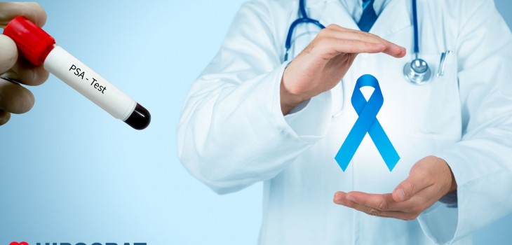 Testul PSA: Cea mai eficientă metodă de depistare precoce a cancerului de prostată